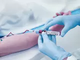 Revolutionize Patient Care with Point-of-Care Testing (POCT)